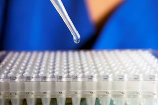 Patients received alemtuzumab as part of a reduced intensity condition regimen and demonstrated early immune recovery. Patients received alemtuzumab as part of a reduced intensity condition regimen and demonstrated early immune recovery.