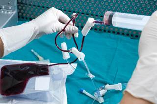 Mortality and relapse incidence were assessed in patients with non-Hodgkin lymphoma after allogeneic hematopoietic cell transplantation (alloHCT). Mortality and relapse incidence were assessed in patients with non-Hodgkin lymphoma after allogeneic hematopoietic cell transplantation (alloHCT).