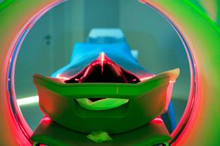 PET-CT scans can reveal abnormalities such as bony lesions and extramedullary disease in patients with multiple myeloma. PET-CT scans can reveal abnormalities such as bony lesions and extramedullary disease in patients with multiple myeloma.