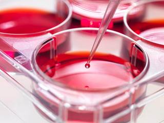 Accessing peripheral blood as a graft source is easier and less invasive than accessing bone marrow. Accessing peripheral blood as a graft source is easier and less invasive than accessing bone marrow.