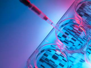 Though patients tended to be older at diagnosis, the severity of genetic hemochromatosis has decreased over time. Though patients tended to be older at diagnosis, the severity of genetic hemochromatosis has decreased over time.