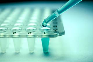 A single-allele mismatch was associated with decreased risk of non-relapse mortality and overall mortality compared with a single-antigen mismatch. A single-allele mismatch was associated with decreased risk of non-relapse mortality and overall mortality compared with a single-antigen mismatch.