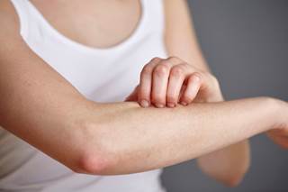 Though the majority of patients with cutaneous T cell lymphomas experience pruritus, the pathophysiology of the symptom is relatively unclear. Though the majority of patients with cutaneous T cell lymphomas experience pruritus, the pathophysiology of the symptom is relatively unclear.
