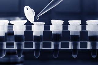 Novel molecular technologies for detecting minimal residual disease may offer prognostic value for patients with indolent lymphomas. Novel molecular technologies for detecting minimal residual disease may offer prognostic value for patients with indolent lymphomas.