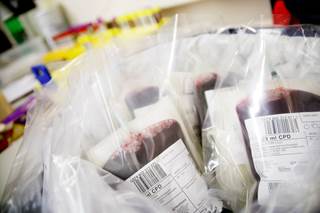 The drug’s ability to boost late-stage erythropoiesis makes it a potential treatment option for patients with beta-thalassemia. The drug’s ability to boost late-stage erythropoiesis makes it a potential treatment option for patients with beta-thalassemia.