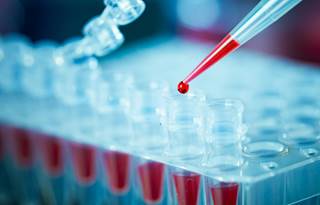 Measurable residual disease status can inform treatment for patients with ALL, but the optimal methods for assessment and interpretation are unclear. Measurable residual disease status can inform treatment for patients with ALL, but the optimal methods for assessment and interpretation are unclear.
