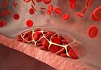 Updated Clinical Practice Guidelines for Venous Thromboembolism: Pregnant and Pediatric Patients Updated Clinical Practice Guidelines for Venous Thromboembolism: Pregnant and Pediatric Patients