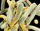 No Cases of Latent Tuberculosis Reactivation After Hematopoietic Cell Transplantation No Cases of Latent Tuberculosis Reactivation After Hematopoietic Cell Transplantation