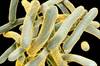 No Cases of Latent Tuberculosis Reactivation After Hematopoietic Cell Transplantation No Cases of Latent Tuberculosis Reactivation After Hematopoietic Cell Transplantation